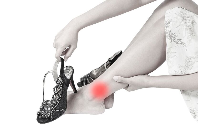 Sakit sa ankle joint tungod sa arthrosis