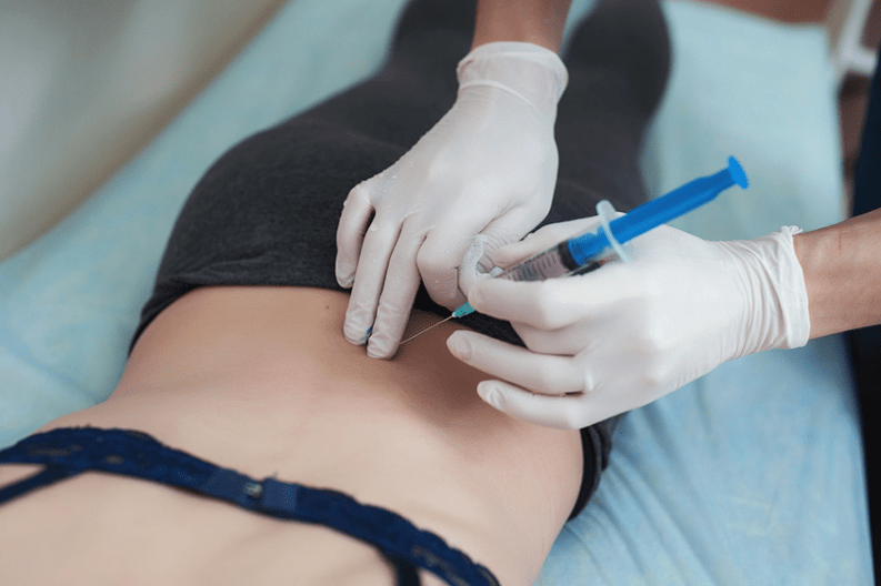 blockade sa lumbar osteochondrosis